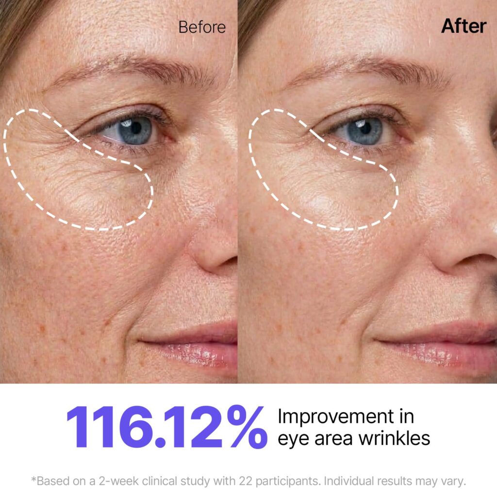 Skincare doesn’t have to feel complicated.
Sometimes the right product makes all the difference.
See full details and customer reviews here.